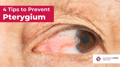 Prevent pterygium article header – First Aid Article in Greenwich